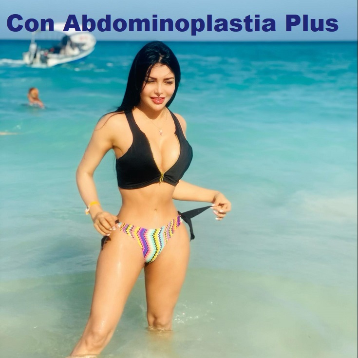 Abdominoplastia plus con 1